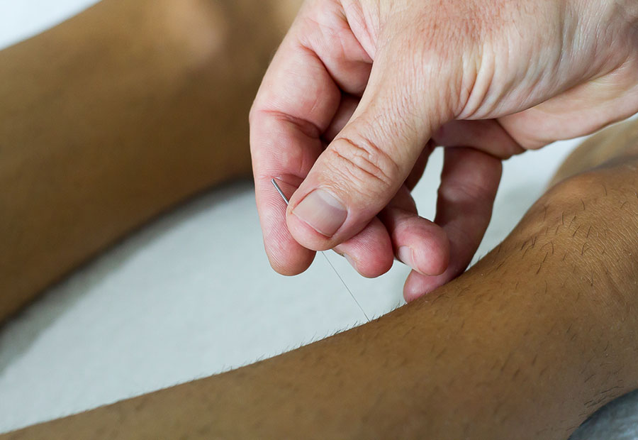 acupuncture-for-knee-pain-near-me